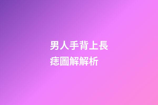 男人手背上長痣圖解解析