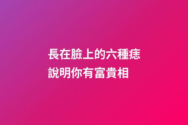 長在臉上的六種痣說明你有富貴相